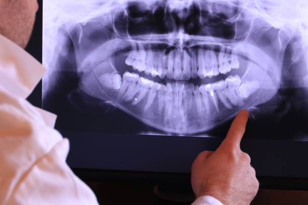 Best Emergency Dental Care for Broken or Chipped Teeth in Mason Neck, VA