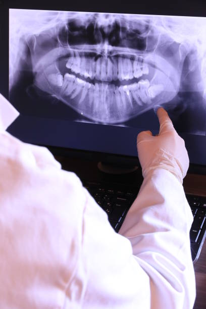 Best Emergency Treatment for Dental Infections or Abscesses in Mason Neck, VA