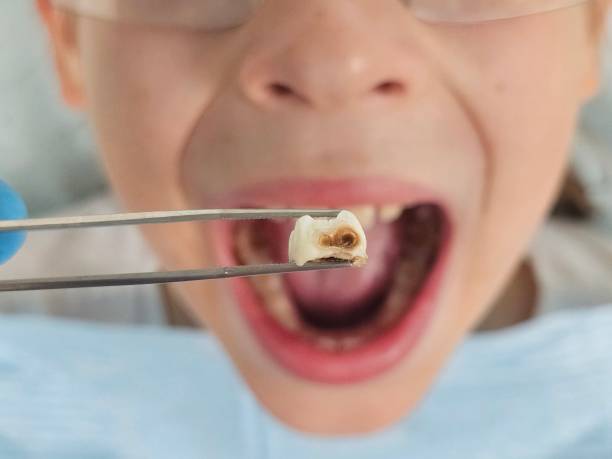 Best Weekend Emergency Dentist in Mason Neck, VA
